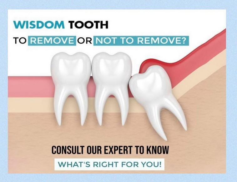 Wisdom teeth, to remove or not? - Archway Dental Group