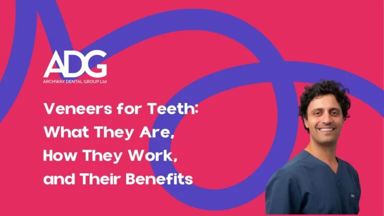 Archway dental group - dentist in Archway00003 Veneers for teeth