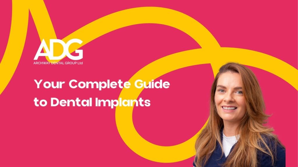 Complete Guide to Dental Implants