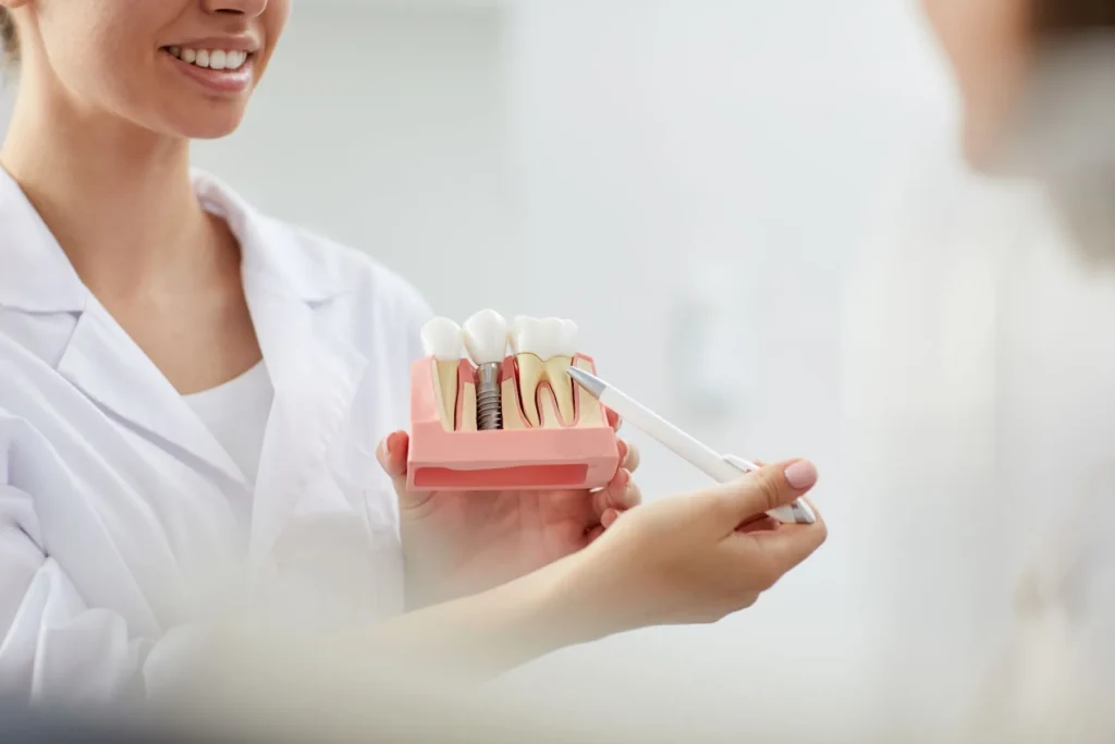 How Long Do Dental Implants Last? A Complete Guide for Patients 1 how long do dental implants last